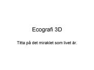 Ecografi 3D
