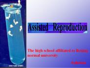 Assisted  Reproduction
