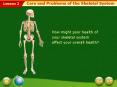 Care and Problems of the Skeletal System PowerPoint PPT Presentation