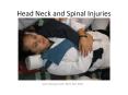 Head Neck and Spinal Injuries PowerPoint PPT Presentation