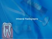 Intraoral Radiographs