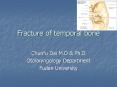 Fracture of temporal bone PowerPoint PPT Presentation