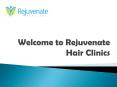 Hair Transplants PowerPoint PPT Presentation