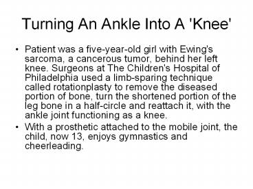 Turning An Ankle Into A 'Knee'