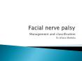 Facial nerve palsy PowerPoint PPT Presentation