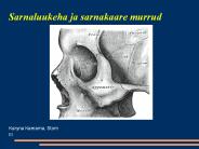 Sarnaluukeha ja sarnakaare murrud