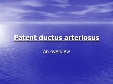 Patent ductus arteriosus