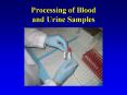 Processing of Blood and Urine Samples PowerPoint PPT Presentation