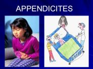 APPENDICITES