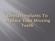 Dental Implants To Replace Your Missing Teeth (1)