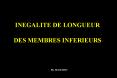 INEGALITE DE LONGUEUR DES MEMBRES INFERIEURS PowerPoint PPT Presentation