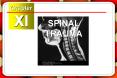 SPINAL%20TRAUMA PowerPoint PPT Presentation