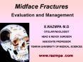 Midface Fractures PowerPoint PPT Presentation