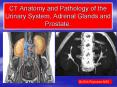 CT Anatomy and Pathology of the Urinary System, Adrenal Glands and Prostate. PowerPoint PPT Presentation