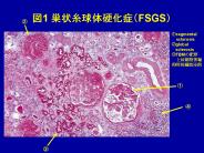 ?1 ????????(FSGS)