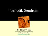Nefrotik Sendrom