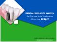 Affordable and High Quality Dental Implants in Sydney & Melbourne