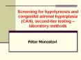 Screening%20for%20hypotyreosis%20and%20congenital%20adrenal%20hyperplasia%20(CAH),%20second-tier%20testing%20 PowerPoint PPT Presentation
