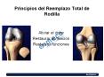 Principios del Reemplazo Total de Rodilla PowerPoint PPT Presentation