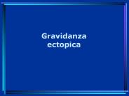 Gravidanza ectopica