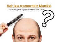 Hair loss treatment in Mumbai