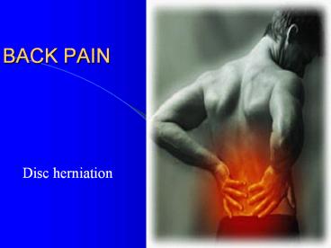 BACK PAIN