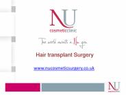 The Realities About Hair Transplantation