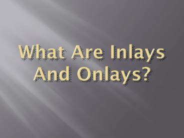 What Are Inlays And Onlays