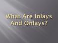 What Are Inlays And Onlays PowerPoint PPT Presentation