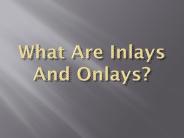 What Are Inlays And Onlays
