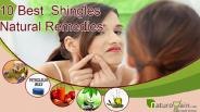 Best Known Shingles Natural Remedies For Quick Relief