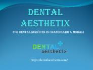 Best Dental Clinic in Mohali