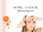 Acne - Cause and Treatment