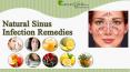 Natural Sinus Infection Remedies For Immediate Relief From Blockage PowerPoint PPT Presentation