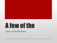 What Mesothelioma Symptoms Are there?