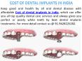 Low Cost of Dental Implants or Cosmetic Surgery in Gujarat India PowerPoint PPT Presentation