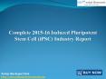 JSB Market Research: Complete 2015-16 Induced Pluripotent Stem Cell (iPSC) Industry Report PowerPoint PPT Presentation
