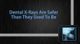 Dental X-Rays Are Safer Than They Used To Be PowerPoint PPT Presentation