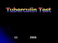 Tuberculin Test PowerPoint PPT Presentation