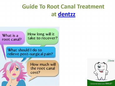 Guide To Root Canal Treatmentat dentzz