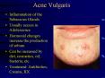 Acne Vulgaris PowerPoint PPT Presentation