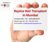 hair transplant in india