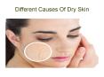 Different Causes Of Dry Skin PowerPoint PPT Presentation