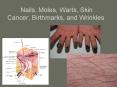 Nails, Moles, Warts, Skin Cancer, Birthmarks, and Wrinkles PowerPoint PPT Presentation