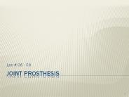 Joint Prosthesis