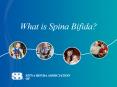 SPINA%20BIFIDA%20ASSOCIATION PowerPoint PPT Presentation