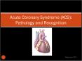 Acute Coronary Syndrome (ACS): Pathology and Recognition PowerPoint PPT Presentation
