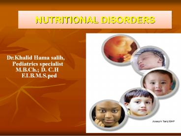 NUTRITIONAL DISORDERS