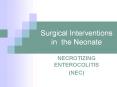 Surgical Interventions in the Neonate PowerPoint PPT Presentation