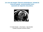 Un caso de Imagen: Fibrosis miotendinosa aislada de m